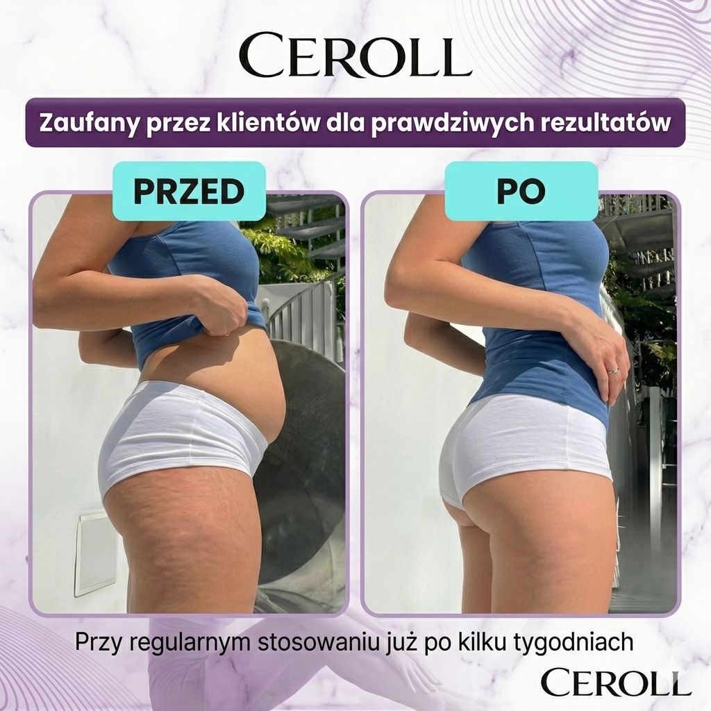 CEROLL | Roller Antycellulitowy