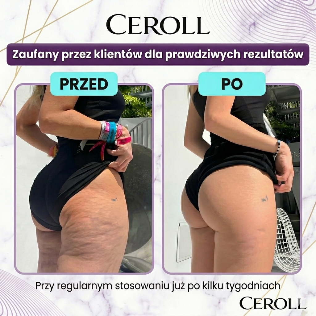 CEROLL | Roller Antycellulitowy