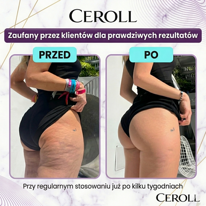 CEROLL | Roller Antycellulitowy